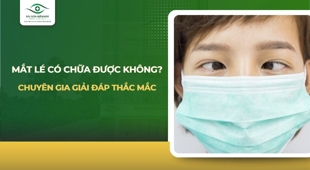 Mắt lé có chữa được không