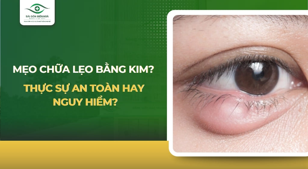 Mẹo chữa lẹo mắt bằng kim