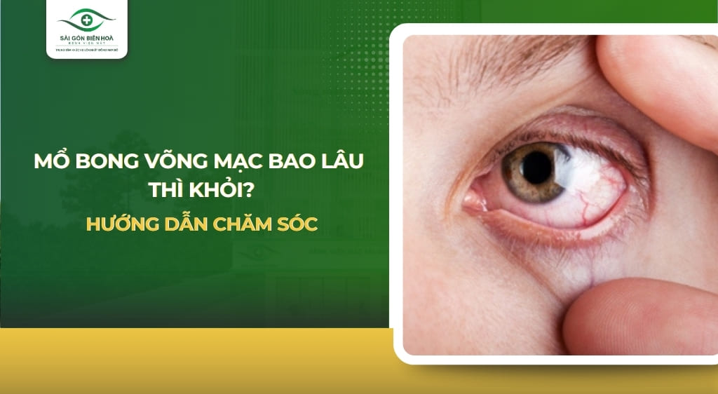 mổ bong võng mạc bao lâu thì khỏi