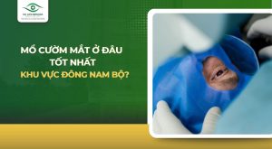 mổ cườm mắt ở đâu tốt nhất