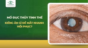 mổ đục thủy tinh thể kiêng ăn gì