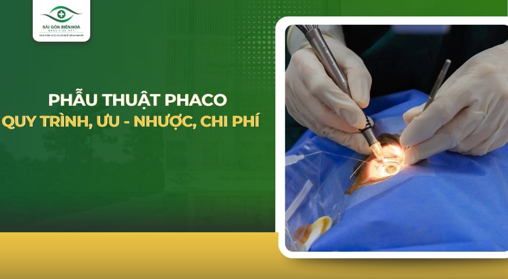phẫu thuật phaco