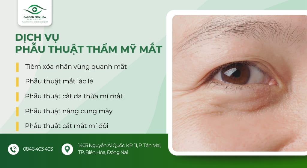 thẩm mỹ mắt