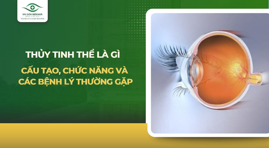 thủy tinh thể là gì