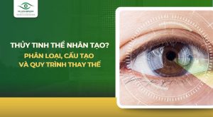 thủy tinh thể nhân tạo