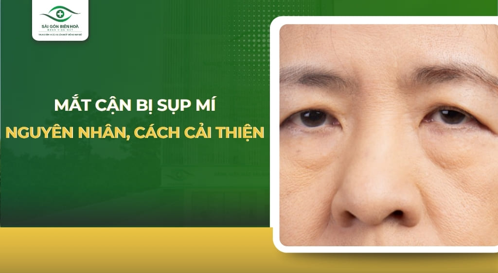 mắt cận bị sụp mí