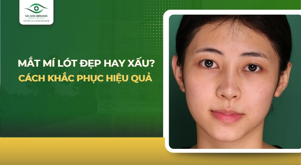 mắt mí lót đẹp hay xấu​