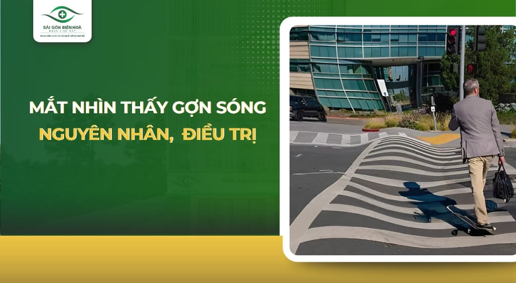 mắt nhìn thấy gợn sóng