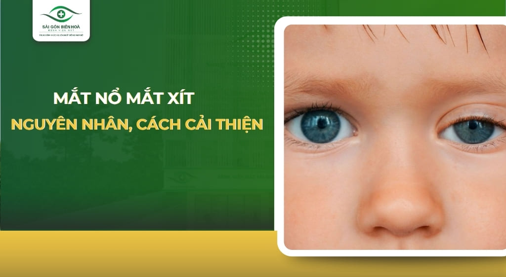mắt nổ mắt xịt