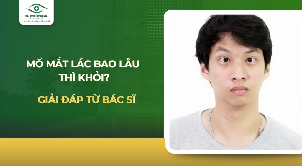 mổ mắt lác bao lâu thì khỏi