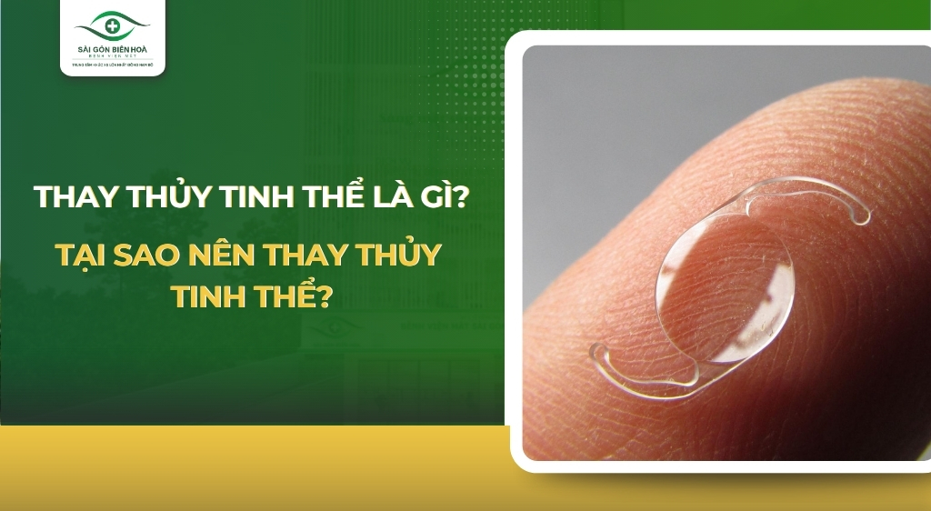 Thay thuỷ tinh thể là gì