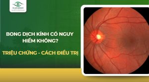 Bong dịch kính