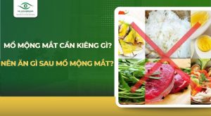 Mổ mộng mắt cần kiêng gì