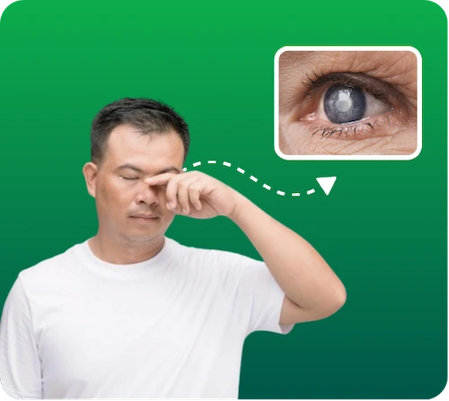 Phẫu thuật cườm nước