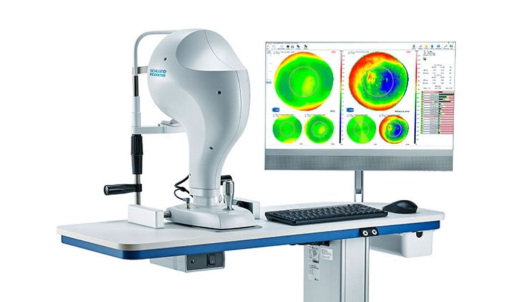 Bản đồ giác mạc 3D hiển thị trên máy Schwind Sirius