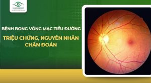 bệnh võng mạc tiểu đường