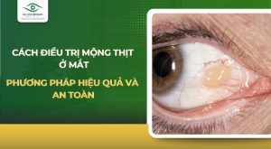 cách điều trị mộng thịt ở mắt