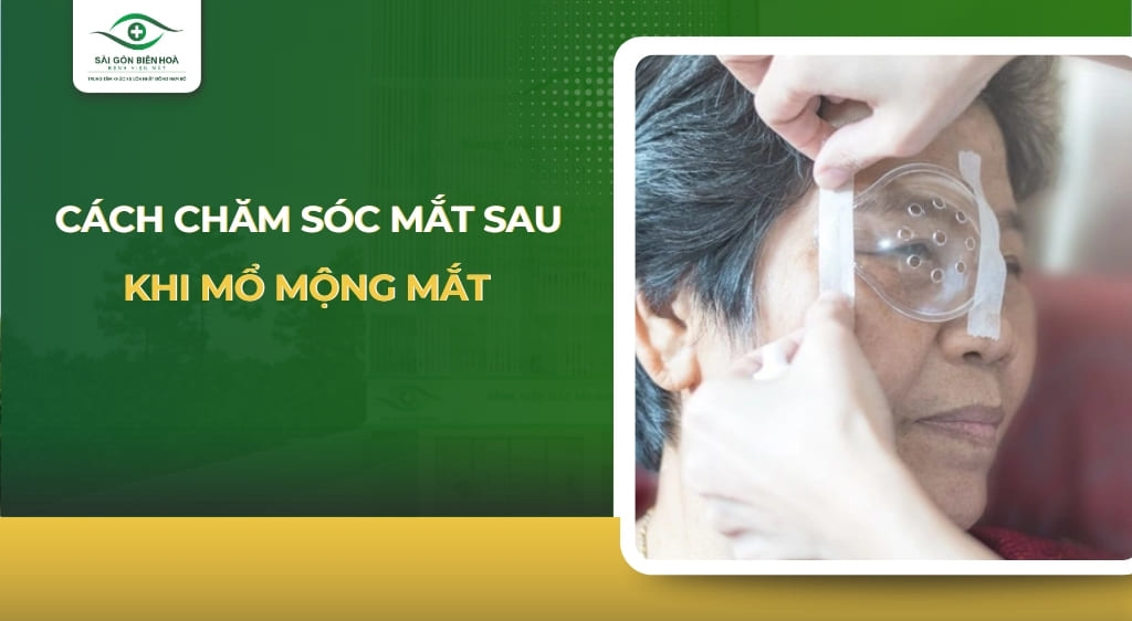 chăm sóc mắt sau khi mổ mộng thịt