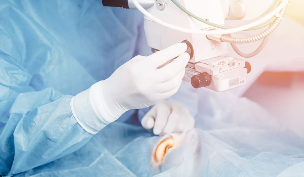 CLEAR và SMILE với khác biệt về tạo lenticule và kích thước đường rạch giác mạc