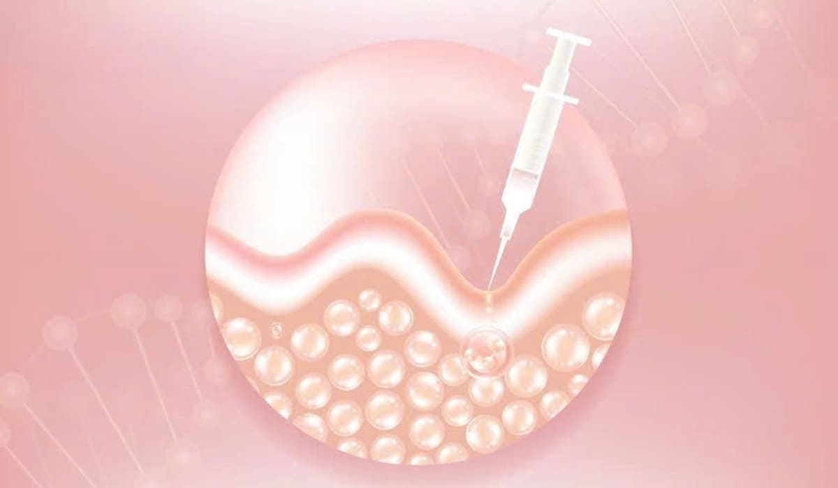 Cơ chế hoạt động của tiêm Botox xóa nhăn vùng mắt