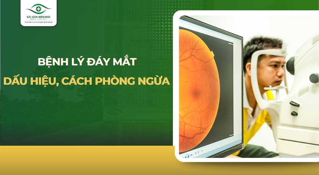 đáy mắt