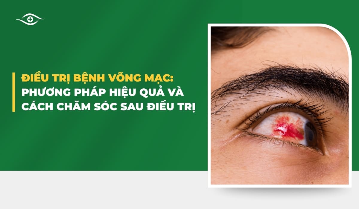 Điều trị bệnh võng mạc