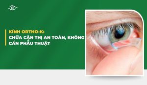 Điều trị khúc xạ bằng Ortho-K