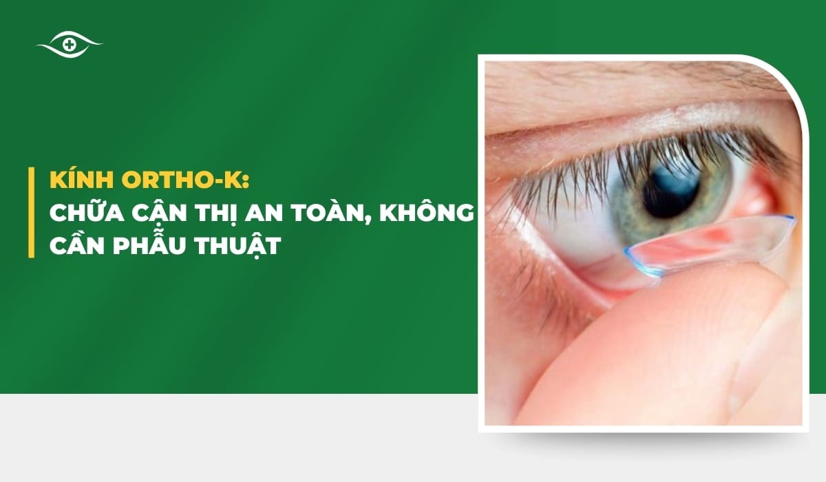 Điều trị khúc xạ bằng Ortho-K