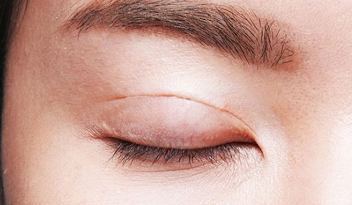 Giữ vết mổ sạch và khô, vệ sinh nhẹ nhàng bằng dung dịch sát khuẩn theo đúng hướng dẫn của bác sĩ