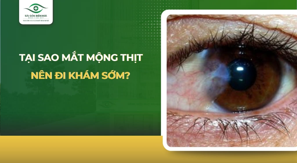 mắt mộng thịt nên đi khám sớm