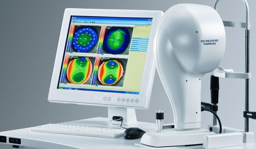 Máy Schwind Sirius đo và phân tích biểu đồ giác mạc cho phẫu thuật khúc xạ