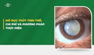 Mổ đục thủy tinh thể