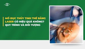 Mổ đục thủy tinh thể bằng laser
