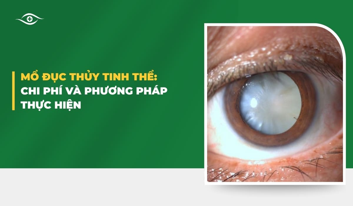 Mổ đục thủy tinh thể