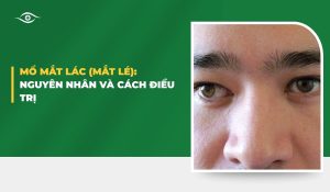 mổ mắt lác