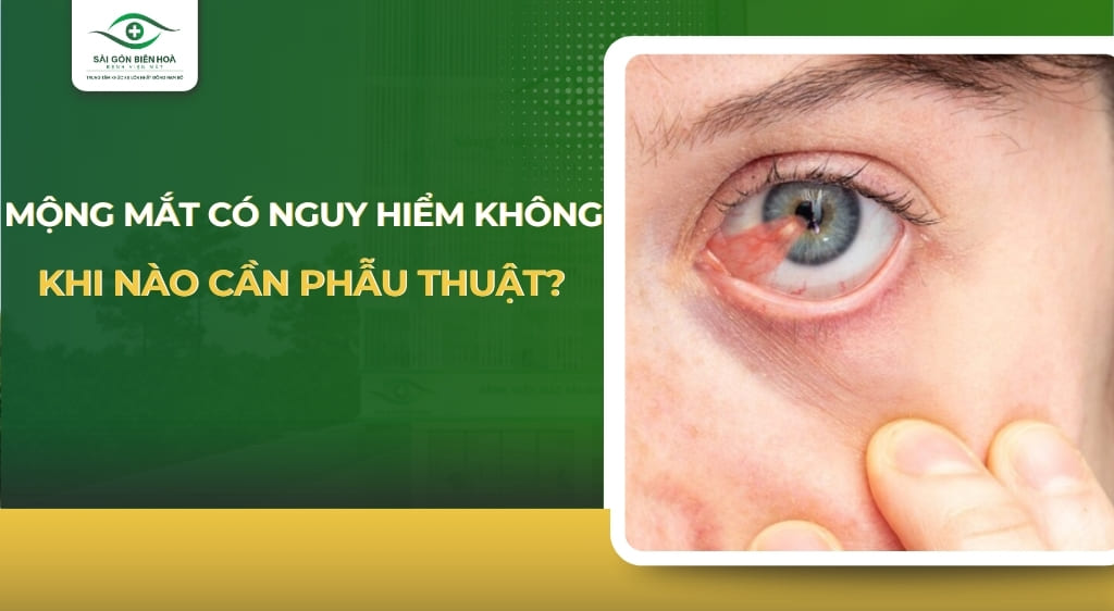mộng mắt có nguy hiểm không