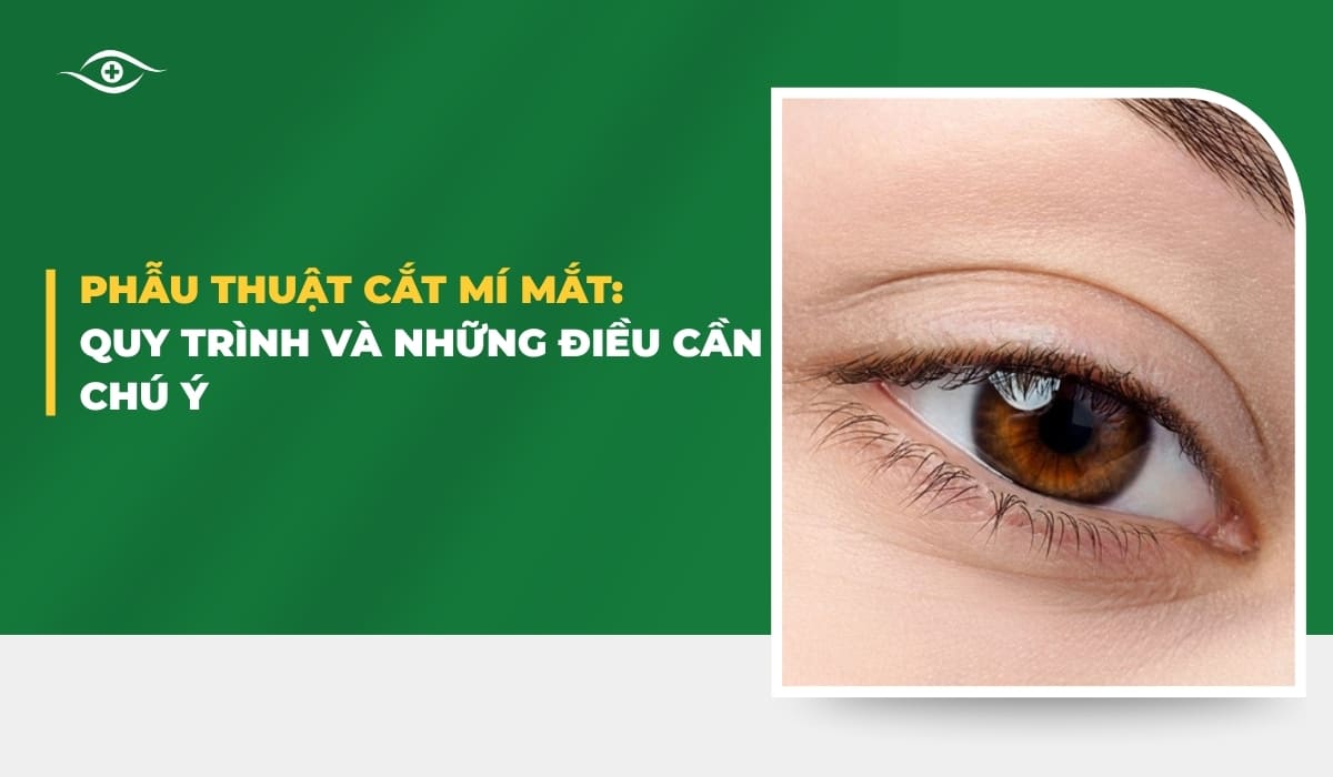 Phẫu thuật cắt mí mắt