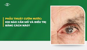 Phẫu thuật cườm nước