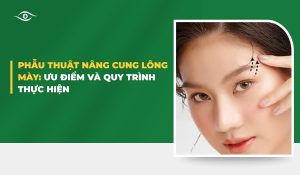 Phẫu thuật nâng cung lông mày