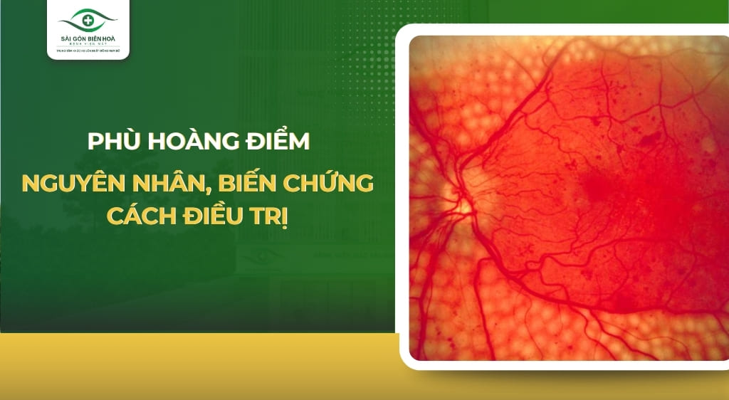 phù hoàng điểm