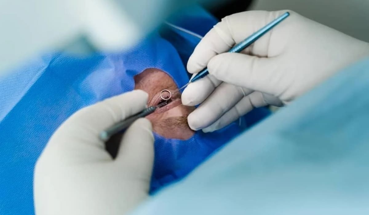 Sau điều trị bong võng mạc, cần nghỉ ngơi, dùng thuốc đúng cách và kiểm soát bệnh nền