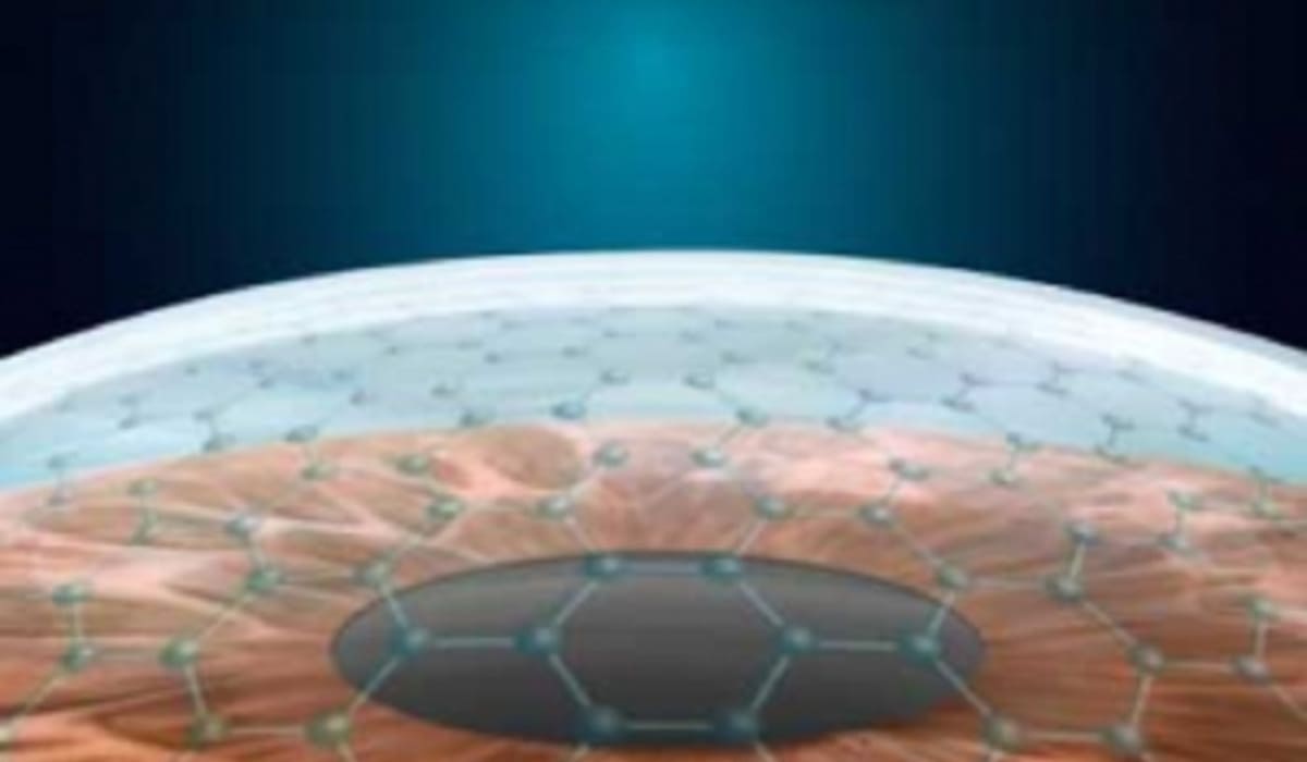 SmartSurface không tạo vạt giác mạc phù hợp cho giác mạc mỏng