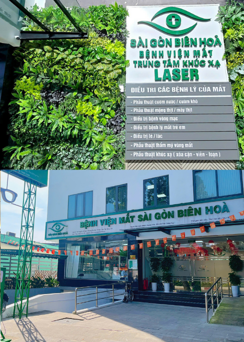 Tại sao nên chon Bệnh viện Mắt Sài Gòn Biên Hòa