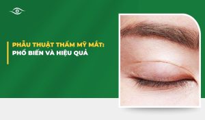 thẩm mỹ mắt