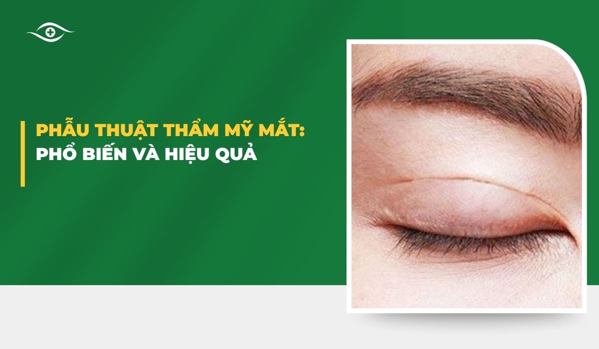 thẩm mỹ mắt