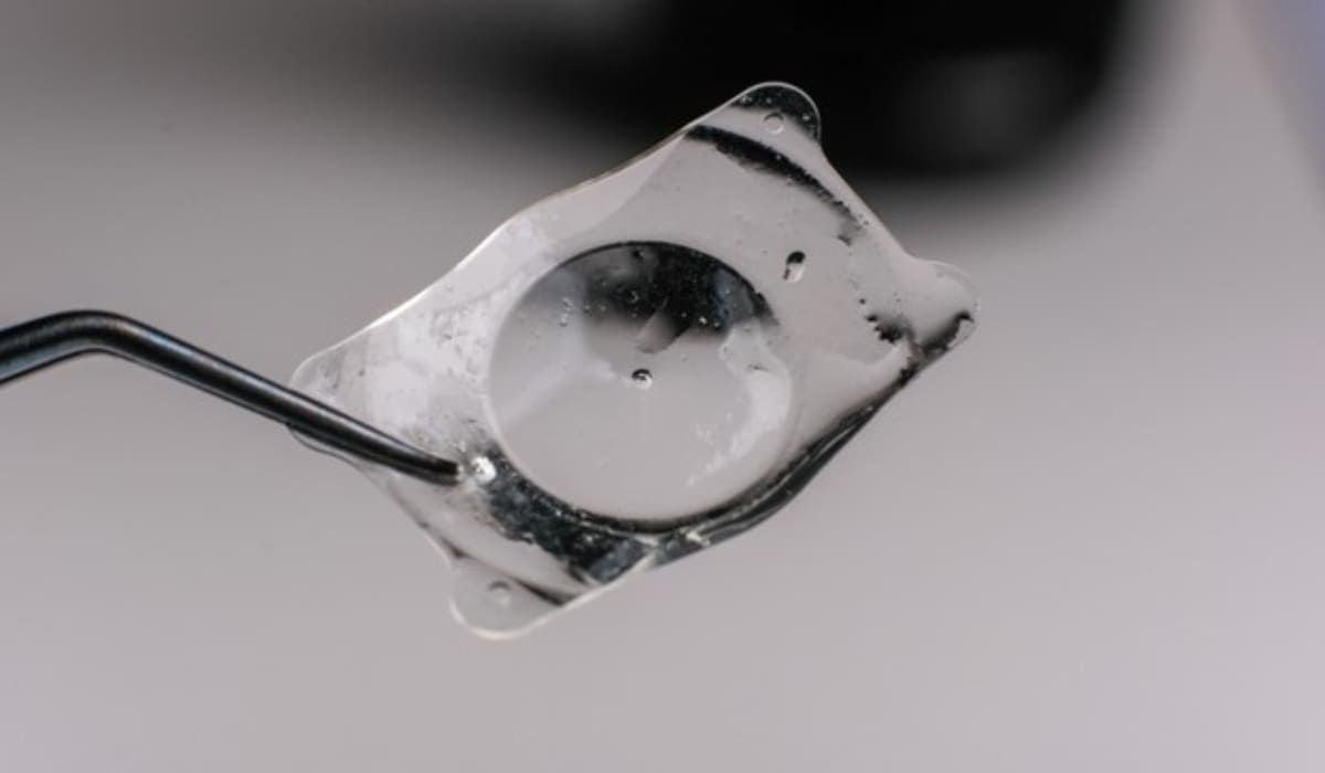 Thấu kính nội nhãn Phakic IPCL được thiết kế riêng cho từng đôi mắt