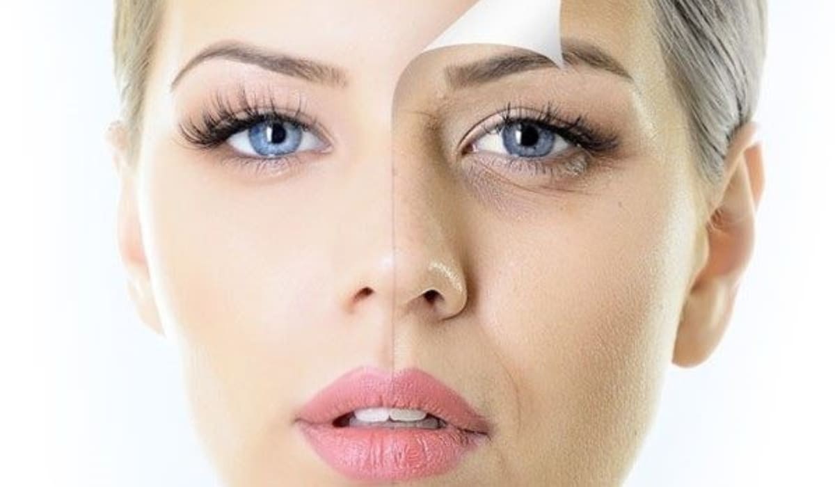 Thủ thuật cắt da thừa mí mắt giúp loại bỏ nhược điểm, đem lại sự cân đối và rạng rỡ cho đôi mắt