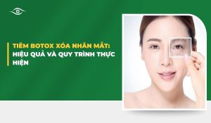 Tiêm botox xóa nhăn mắt