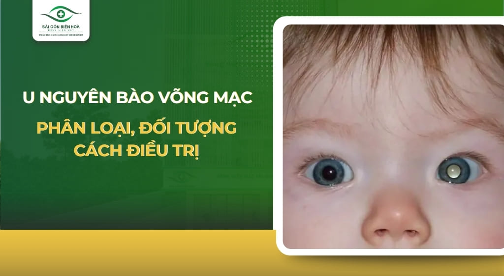 u nguyên bào võng mạc