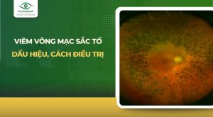 viêm võng mạc sắc tố